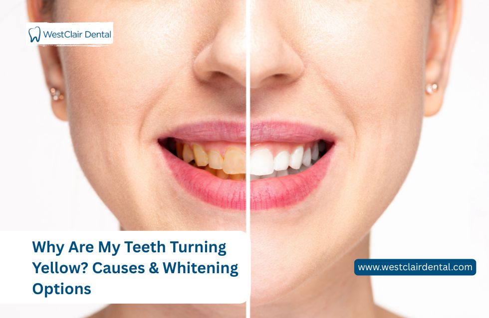 Why Are My Teeth Turning Yellow? Causes & Whitening Options